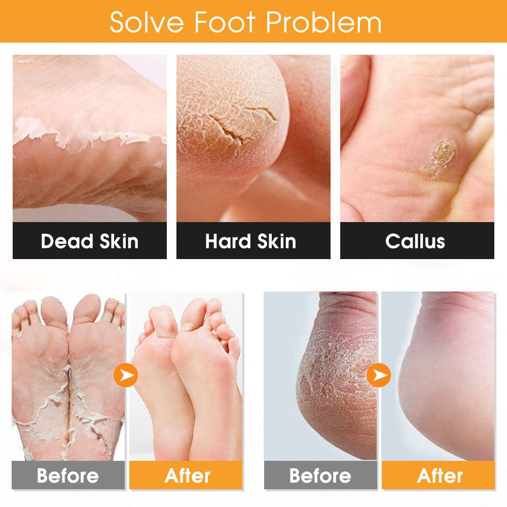 22 in 1 Pedicure Tools