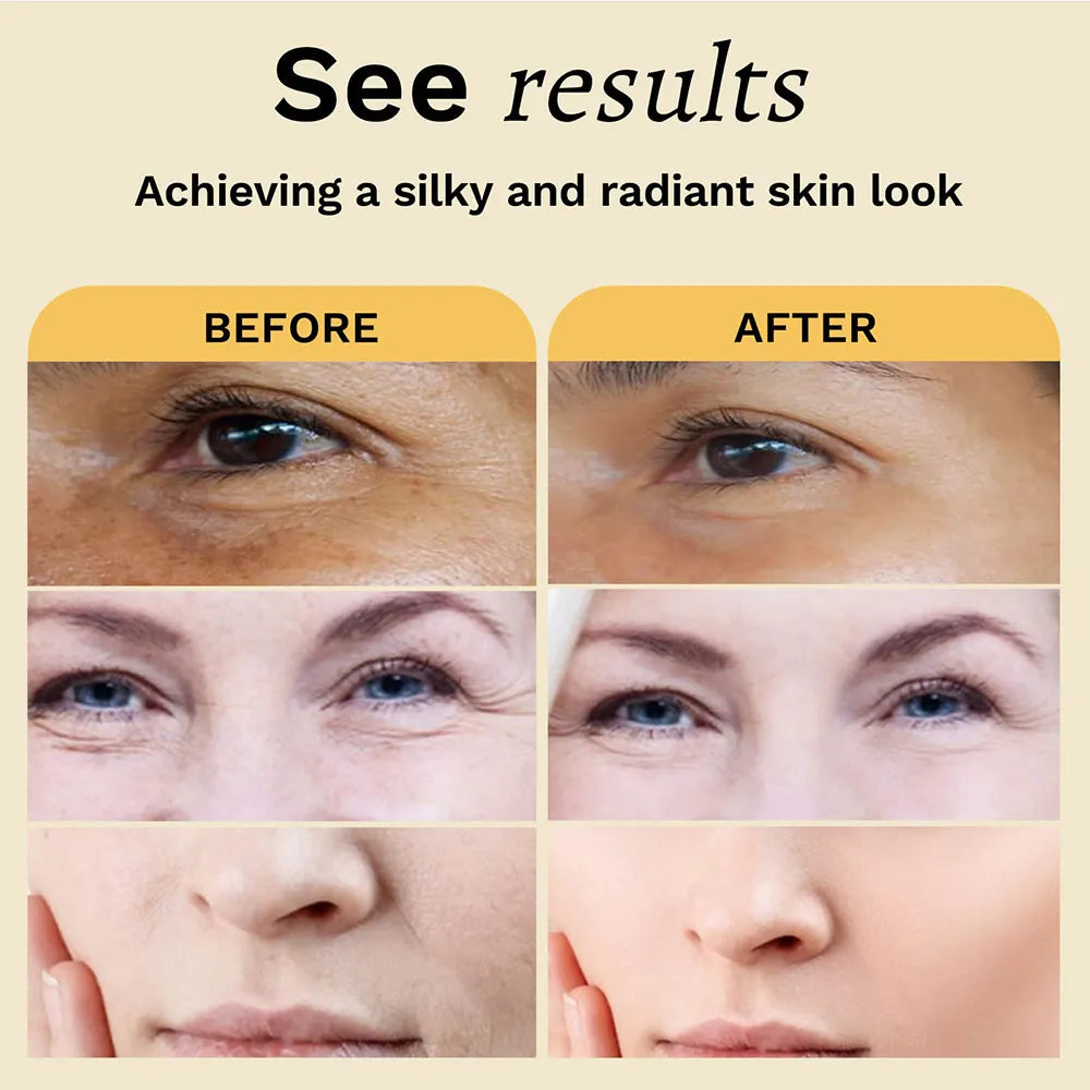 Dark Spots Toners Eraser for Dark Skin