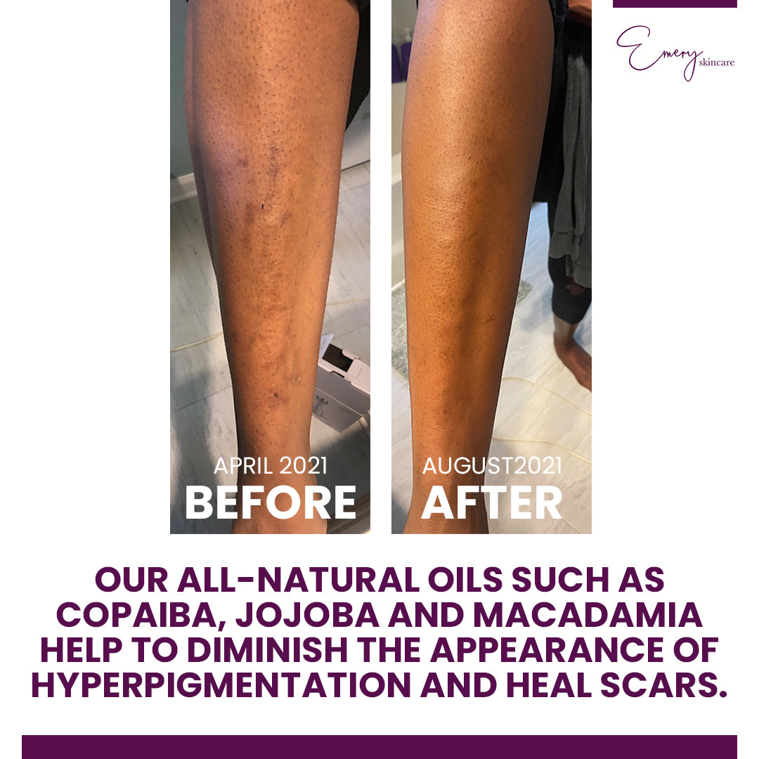 Exfoliating Body Scrub