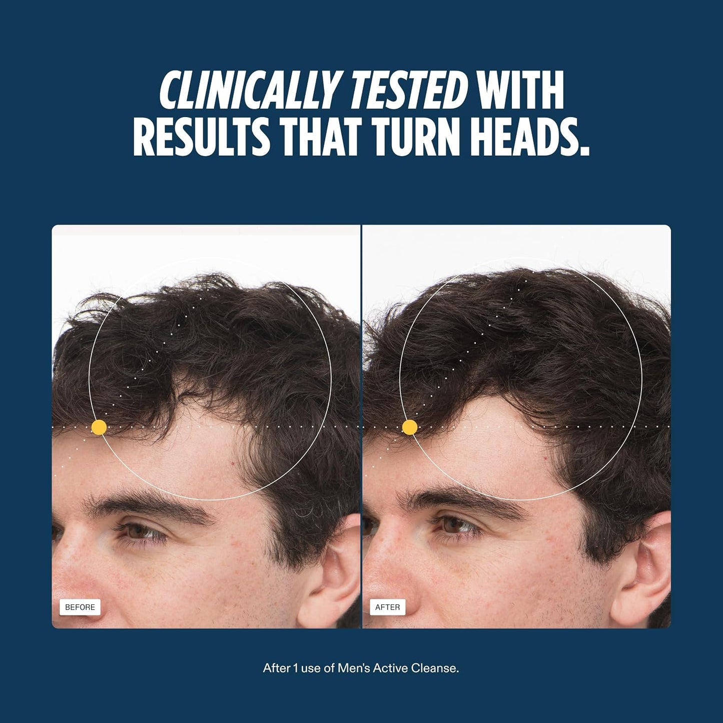 https://m.media-amazon.com/images/I/81zVOXu4uKL._SL1500_.jpg