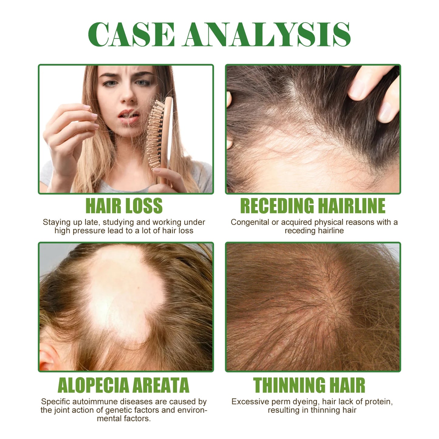 Rosemary Hair Care Nourish, Strengthen Roots  | Relieve Scalp Tension