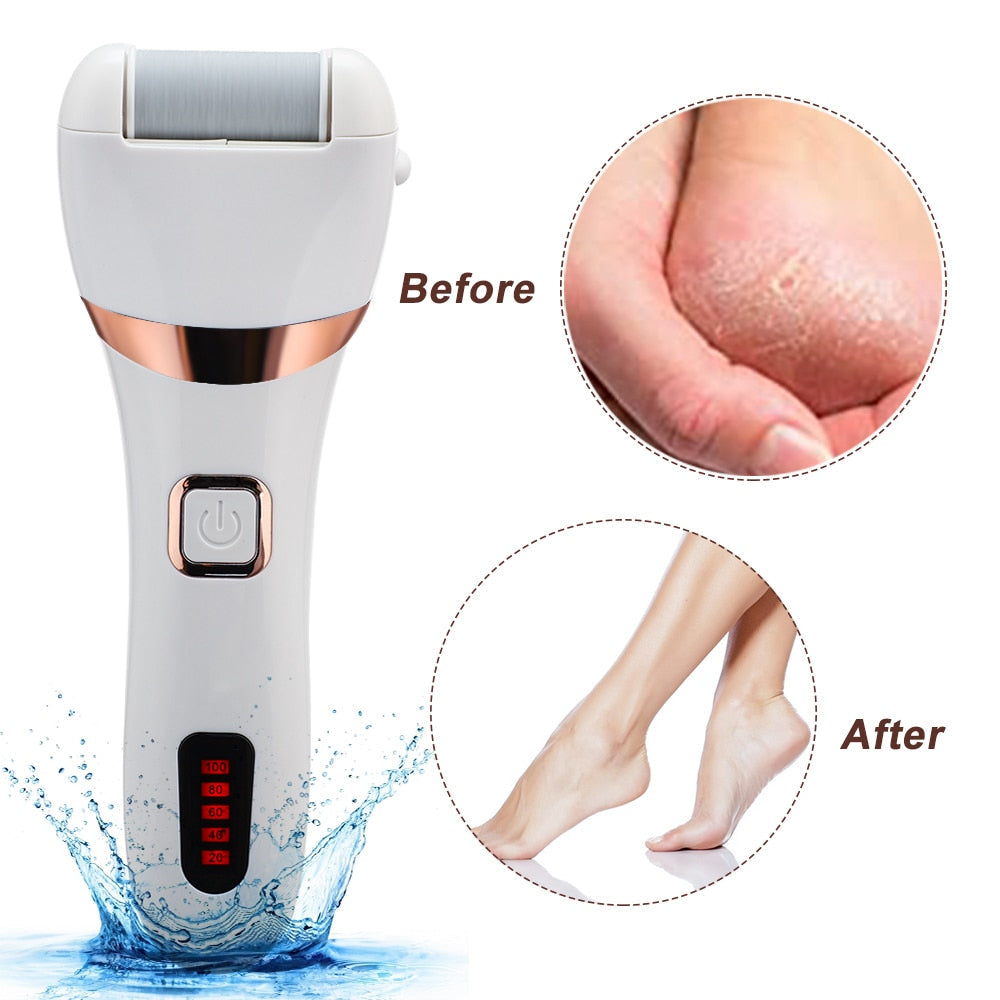 Pedicure Dead Skin remover