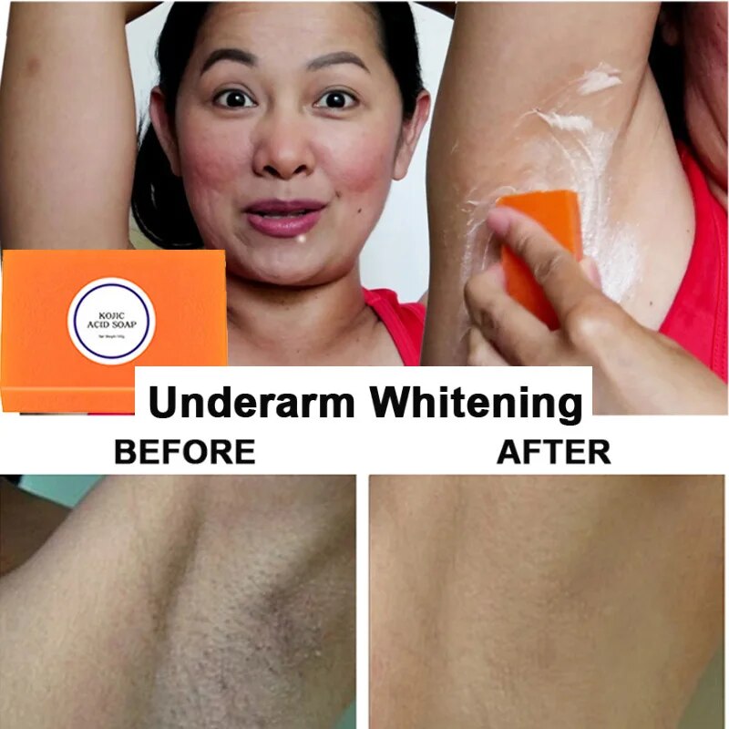 Handmade Glutathione Whitening Soap
