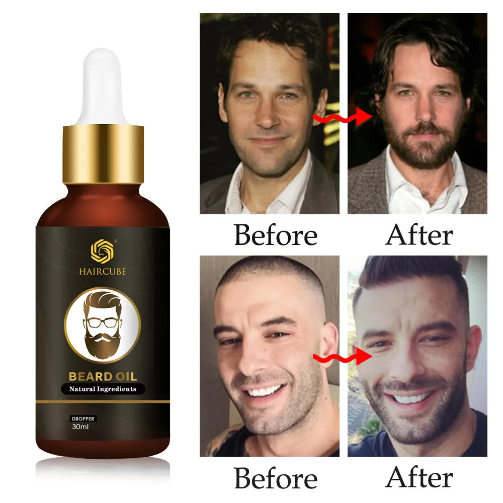 Thicken| Nourishing Beard Oil