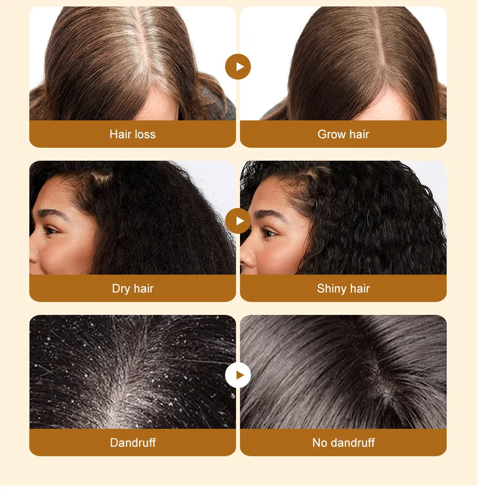 Naturals Batana Oil  For Fast Hair Growth| Shiny Hair| Anti Hair Loss