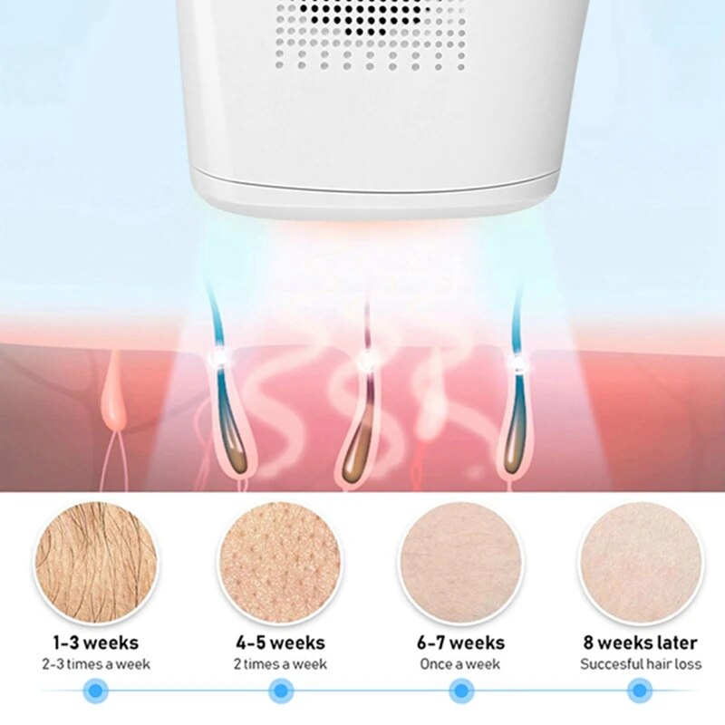 Epilator Laser-Permanent Hair Removal