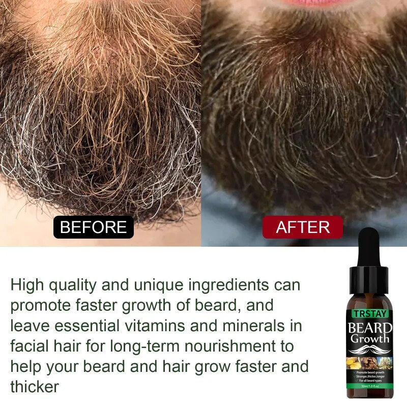 Beard Hair Growth - Essential Oil Anti Hair Loss