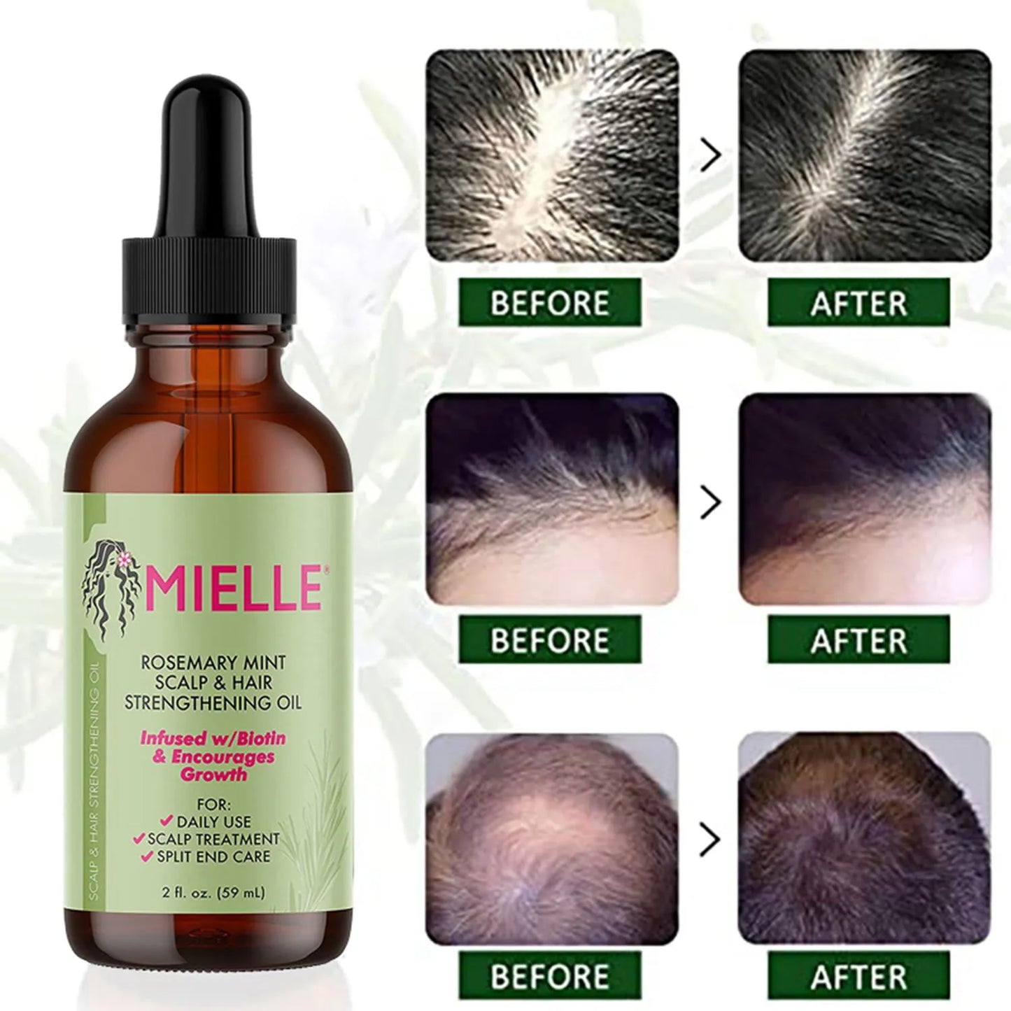 Rosemary Oil Mint Hair Strengthening