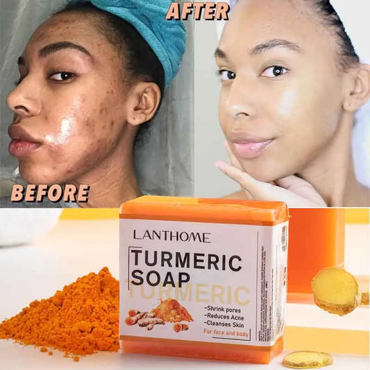 Turmeric  Anti Acne Cleansing |Remove Pimples | Dark Spots Lightening Soap