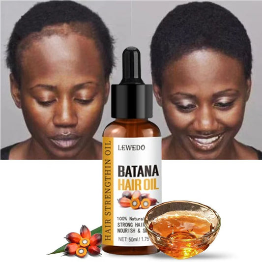 Naturals Batana Oil  For Fast Hair Growth| Shiny Hair| Anti Hair Loss