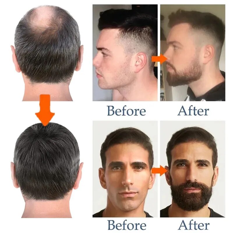 Serum Hair Growing Essential Oil