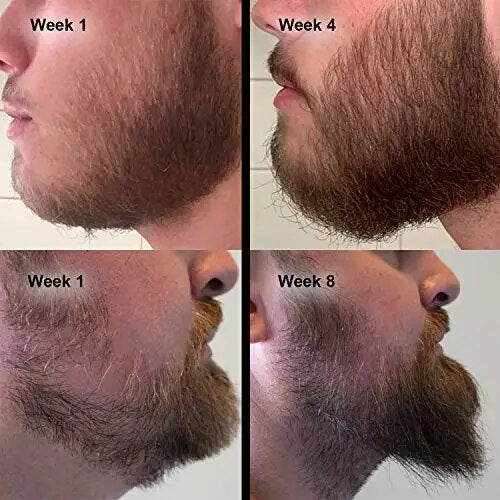 Beard Growth Oil Serum