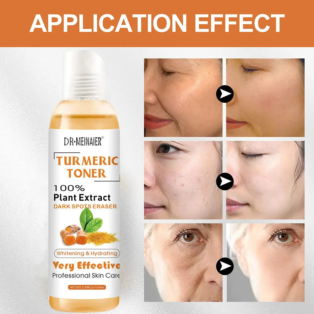 Dark Spots Toners Eraser for Dark Skin